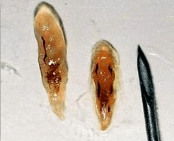 Opistorchi
