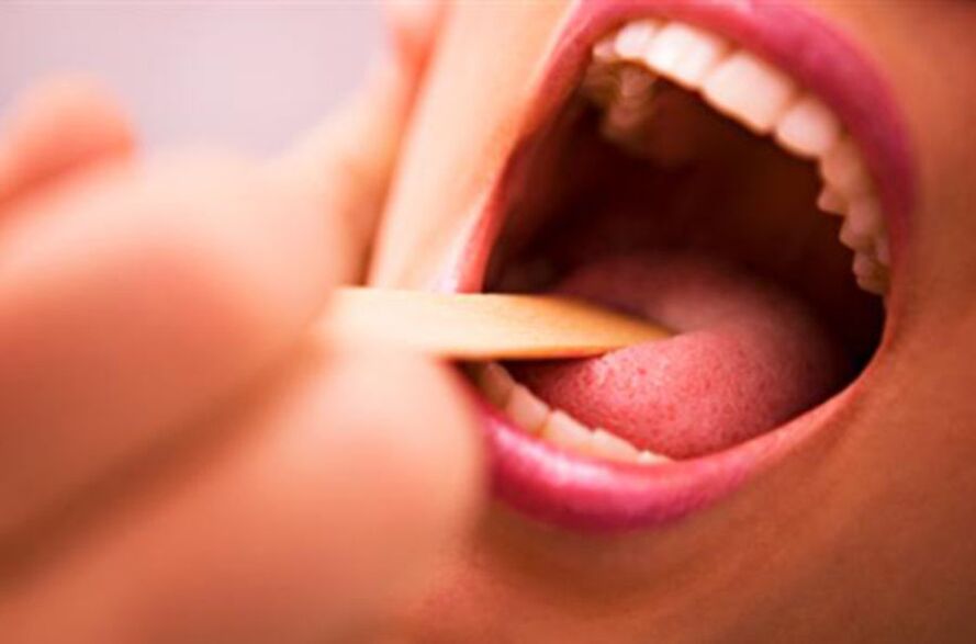 Types of parasites found in the human mouth